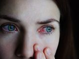 Conjunctivitis: Home Remedies For Quick Relief 