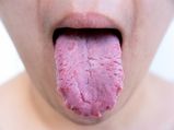 Your Tongue Can Tell A Lot About Your Health Condition; Read To Find Out!