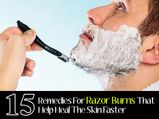 15 Home Remedies For Razor Burns That Help Heal The Skin Faster 