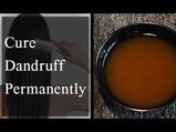 Hair Solution To Cure Dandruff