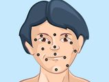 Your Face Moles Reveal About Your Personality