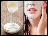 Amazing DIY Malai (Milk Cream) Remedies For Skin Care