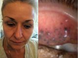 Woman Almost Goes Blind After Sleeping With Mascara For 25 Years!