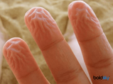 Wrinkled Or Pruney Fingers: What Causes Wrinkled Fingers?