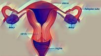 Endometrial Cancer: Causes, Symptoms, Diagnosis And Treatment