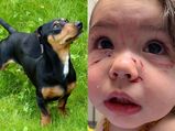 Mum Shares Heartbreaking Pictures Of Baby After Dog Attack