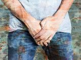 Penile Vitiligo (Vitiligo Penis) : Symptoms, Causes, Diagnosis & Treatment