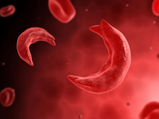 Sickle Cell Anaemia: Types, Causes, Symptoms & Treatment