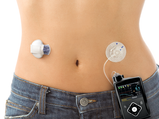 Insulin Pump Therapy: How It Works, Advantages & Disadvantages 