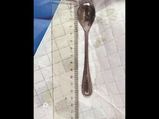 Woman Had A Spoon Stuck In Her Body