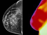 World Cancer Day 2022: Breast Cancer Detection And Mammography Vs Thermography