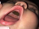 Mum Was Shocked To Discover This In Her Child’s Mouth