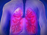 Bronchiectasis: Causes, Symptoms, Diagnosis And Treatment