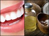 World Coconut Day 2020: Benefits Of Coconut Oil For Teeth And How To Use It