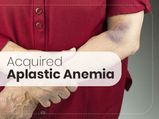 Acquired Aplastic Anaemia: Causes, Symptoms, Diagnosis And Treatment