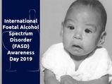 International Foetal Alcohol Spectrum Disorder (FASD) Awareness Day 2019 - Significance