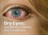 Dry Eyes: Symptoms, Causes, Risk Factors, Treatment And Prevention