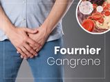Fournier Gangrene: Causes, Symptoms, Risk factors, Treatment, And Prevention