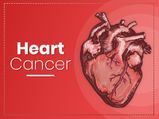 Heart Cancer: Causes, Symptoms, Risk Factors, Treatment And Prevention