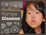Pompe Disease: Types, Causes, Inheritance, Diagnosis & Treatment 