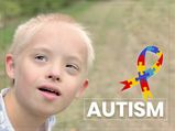 Autism: Symptoms, Causes, Risk Factors, Diagnosis And Treatment