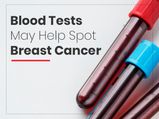 Blood Tests May Help Detect Breast Cancer, Says Recent Study
