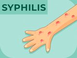 Syphilis: Causes, Symptoms, Diagnosis & Treatment