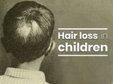 What Are The Common Conditions That Cause Hair Loss In Children?