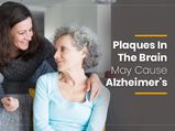 Plaques In The Brain May Cause Alzheimer's Disease, Study Reveals