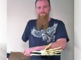 Canadian Man Carries His Amputated Arm Wherever He Goes!