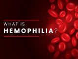 What Is Haemophilia? Its Causes, Symptoms, Complications, Diagnosis & Treatment