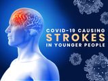 COVID-19: Coronavirus Causing Strokes In Young & Middle-aged People With Mild Symptoms 