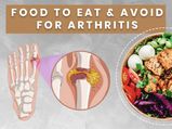 World Arthritis Day 2020: Foods To Eat And Avoid For Arthritis