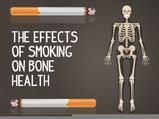 World No Tobacco Day: The Effects Of Smoking On Bone Health