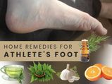 7 Home Remedies To Treat Athlete’s Foot 