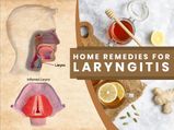 10 Simple Home Remedies for Laryngitis (Hoarse Voice): Number Six Is The Simplest