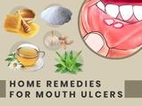 10 Home Remedies That May Help Heal Mouth Ulcers 