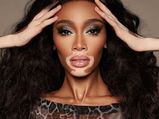 Winnie Harlow’s Quarantine Make-up Routine Is A Keeper For The Stay-At-Home Weekend