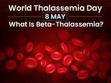 Beta-thalassemia: Causes, Symptoms, Risk Factors, Treatment and Prevention
