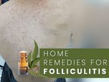 Folliculitis: Simple And Effective Home Remedies