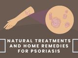 10 Natural Treatments And Home Remedies For Psoriasis Relief