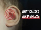 What Causes Ear Pimples And How To Treat Them