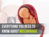 Miscarriage: Causes, Symptoms Risk Factors, Diagnosis, Treatment & Prevention 