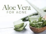 Aloe Vera For Acne: 7 Homemade Remedies To Treat The Issue