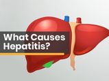 World Hepatitis Day 2021: What Is Hepatitis? Everything You Need To Know About This Condition