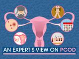 An Expert’s View On Managing PCOD (Polycystic Ovary Disease)