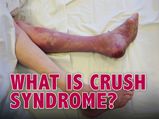 What Happens In Crush Syndrome? Know About Its Causes, Symptoms, Complications And Management