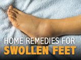 12 Effective Home Remedies For Swollen Feet