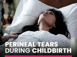 Perineal Tears During Childbirth: Stages Of Labour, Types, Risk Factors And Recovery