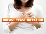 Breast Yeast Infection: Causes, Symptoms, Risk Factors, Treatments And Prevention